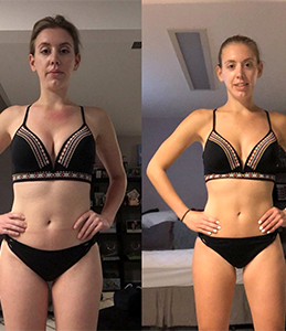 Aimee before and after photo